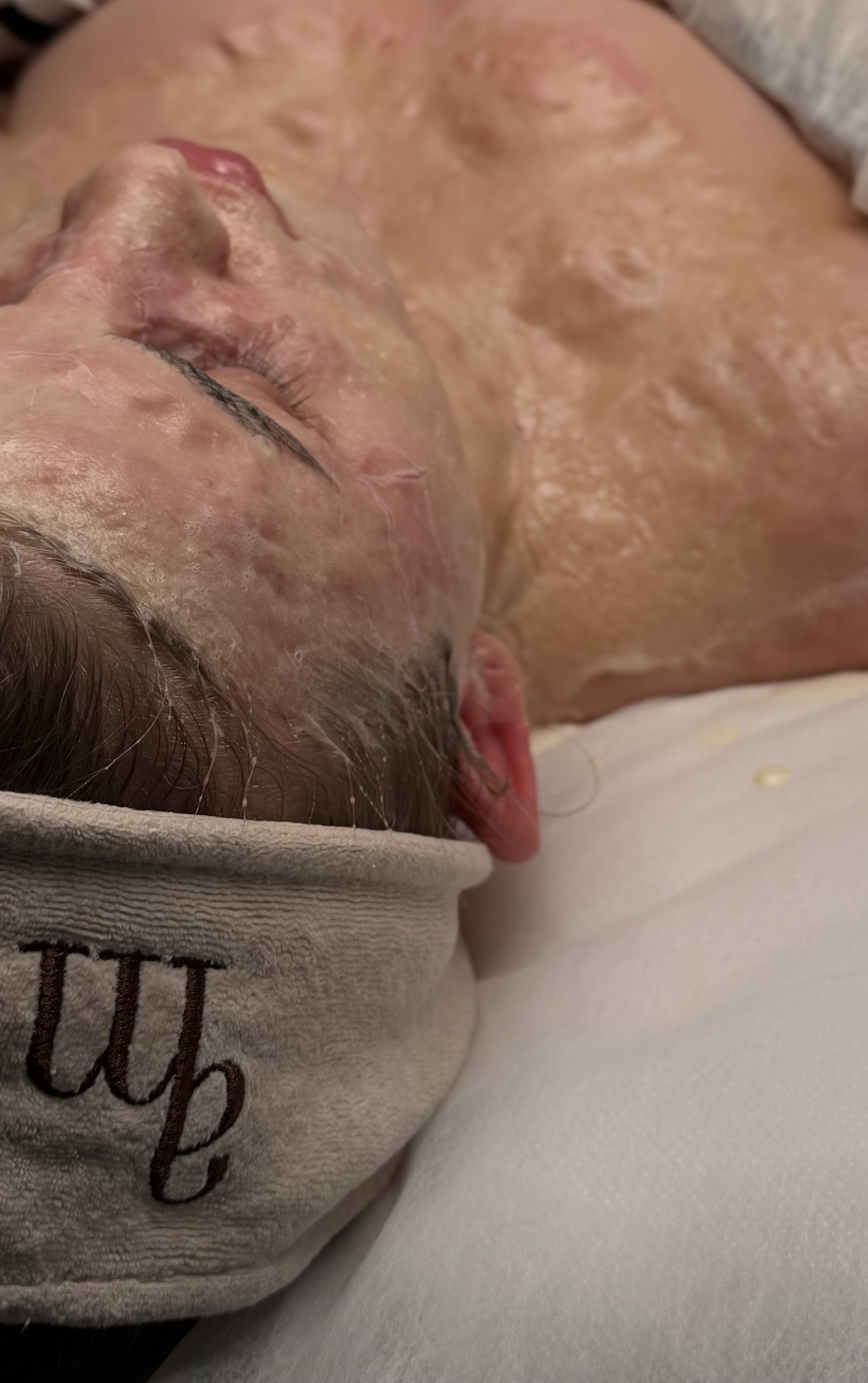 Terapia enzymatyczna DMK - etap przygotowania