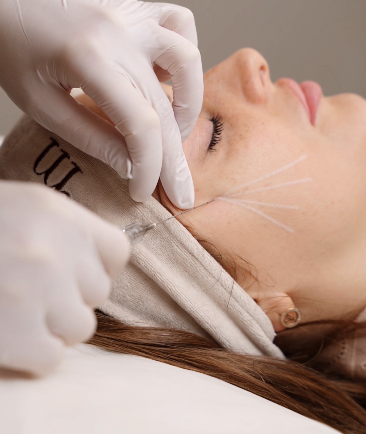 Stymulatory tkankowe - przygotowanie do zabiegu